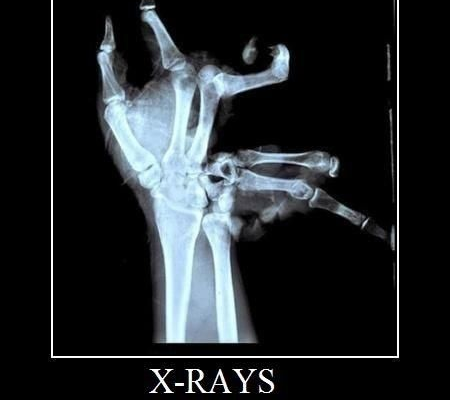 Are you sure I don’t need an MRI scan?