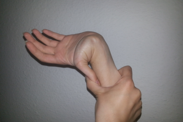 Help, I think I’m hypermobile!
