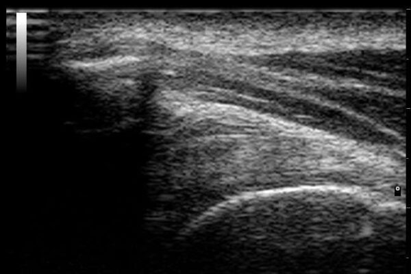 Ultrasound assessment day (shoulders), Saturday 26th October