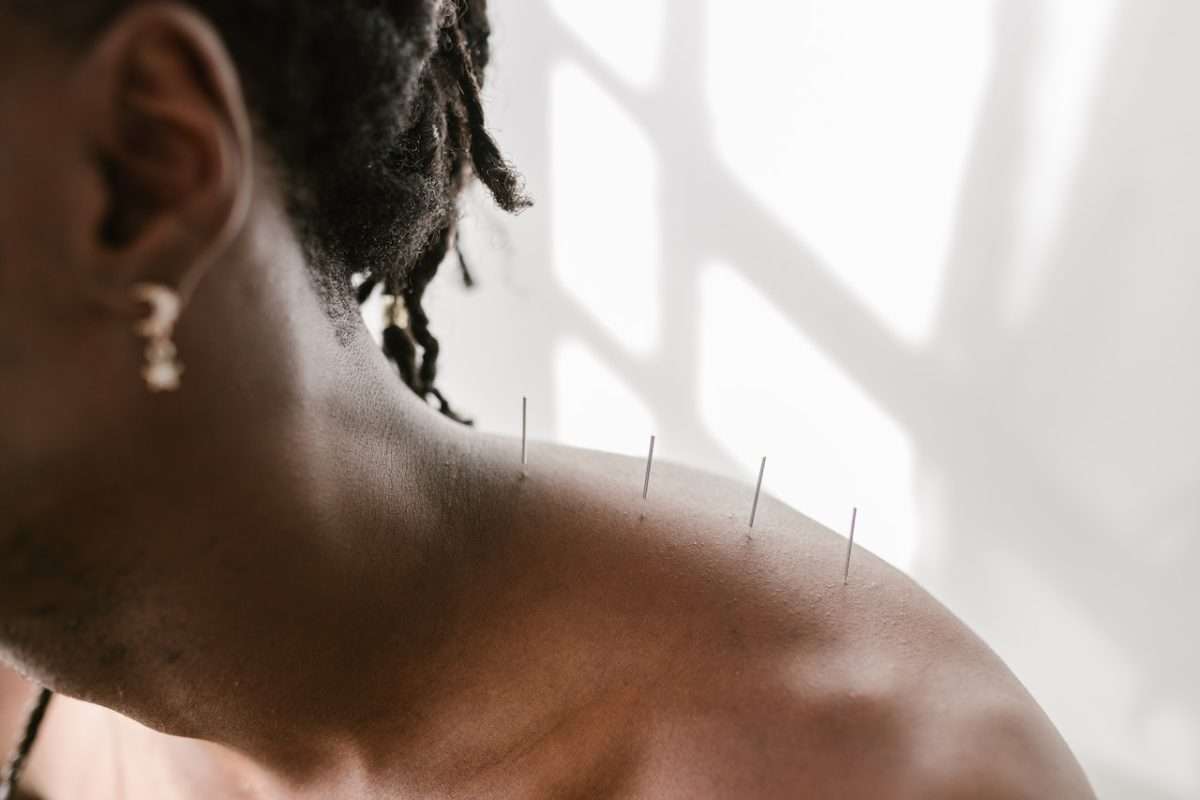 Medical Acupuncture